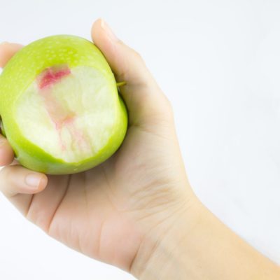 Periodoncia cido bilbao clinica dental